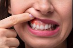 خراج الأسنان… نصائح ذهبية لتفادي الألم والمضاعفات