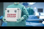 بعد تريند سرقة الأعضاء.. هل هي حقيقة؟ 