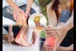 انتبه- 6 أعراض أولية تخبرك بارتفاع حمض اليوريك بجسمك