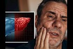 تظهر في الفم- 3 أعراض لمرض الكبد الدهني احذرها