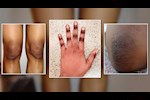 كيف تتخلصين من سواد المفاصل بطرق بسيطة وآمنة؟
