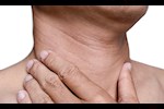 علام تدل الخطوط الداكنة في الرقبة؟