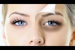 علاج الهالات السوداء بزيت الخروع- هل هذا ممكن؟
