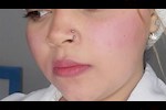 7 أضرار محتملة لثقب الأنف- احذريها