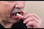 لماذا يفقد كبار السن أسنانهم؟ نصائح للوقاية