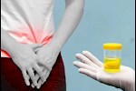 انتبه- 5 أعراض خطيرة تظهر في البول