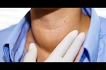 علامات مبكرة لمشاكل الغدة الدرقية