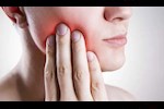 5 أسباب تؤدي إلى آلام ضرس العقل.. طبيب يوضح كيفية التخلص منه