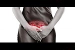 هل يصاب الرجل بالعدوى الفطرية من زوجته؟ طبيب يوضح