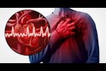 طبيب يوضح أسباب ارتفاع نسبة الإصابة بالجلطات القلبية بين الشباب