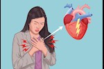 احذري- 5 علامات غير عادية تكشف إصابتِك بالنوبة القلبية