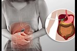 انتبه- 5 علامات تكشف عن وجود مشكلة في المرارة