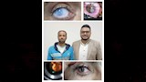 نجاح جراحة دقيقه في العين لمريض في بني سويف  (3)