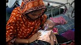 أطفال مصابون بالحصبة_1
