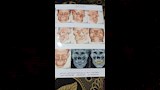 استغاثة مواطن بالغربية بعد الاعتداء عليه (6)