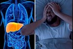 أعراض مرض الكبد الدهني- 5 علامات "هتطيّر النوم من عينيك"