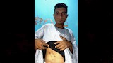 شاب بالمنيا يروي كواليس تصديه لكلب مسعور فى جبل الطير (6)