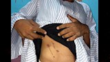 شاب بالمنيا يروي كواليس تصديه لكلب مسعور فى جبل الطير (7)