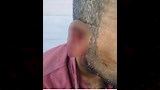 الإصابة