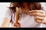 تساقط الشعر بعد حمى الضنك.. طبيبة توضح الأسباب وطرق التعامل