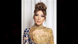 الفنانة أصالة بعد عملية شد الجفون