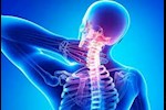 ضيق فقرات الرقبة- طبيب يحذر من تأثيرها على الأعصاب