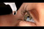 5 أنواع من قطرات العين.. طبيب يوضح حقيقة تأثيرها على النظر
