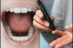علاج جفاف الفم بسبب السكري- نصائح لمريض السكري للتخلص منه