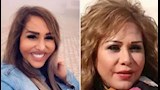 الفنانة مها المصري قبل وبعد التجميل