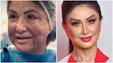 وفاء سالم قبل وبعد عمليات التجميل