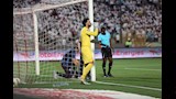 إصابة المهدي سليمان في الشوط الأول من مباراة الزمالك واتحاد العاصمة ودخول محمد عواد بدلا منه (5)