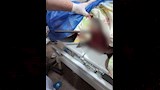 سيخ-طوله-متر-يخترق-جسد-شابة-بالمنوفية