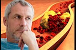 علاج الكوليسترول عند الرجال- 8 طرق طبيعية تغنيك عن الأدوية