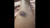 صور من اصابة راندا البحيري في ذراعها (2)