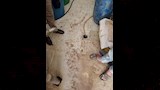 سوء النظافة