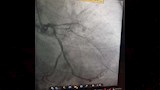 أثناء إجراء  إحدى العمليات