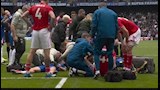 لحظة إصابة جيسي ديري