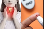 هل السكر له علاقة بالغدة الدرقية؟- حسام موافي يحسم الجدل