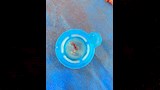جلطة قلبية بعد انقاذ مريض