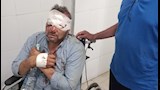 إصابة معلمين في حادث أثناء توجههما لامتحانات الشهادة الإعدادية ببني سويف - صور