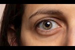 كيف تكشف العين عن أمراض الكبد؟.. أعراض قد تظهر مبكرا    