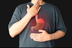 بخلاف ارتجاع المريء- حسام موافي: هذه الأمراض تسبب الحموضة