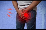 أسباب انتفاخ الخصية بدون ألم- هل له دلالات خطيرة؟       