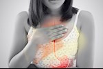  علاج ارتجاع المريء طبيعي- 4 أطعمة قد تخلصك منه نهائيًا