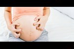 أسباب الحكة والهرش في الثلث الأخير من الحمل.. طبيب يوضح