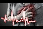 من الأكثر عرضة للإصابة بتمدد الشريان الأورطي؟ استشاري يوضح