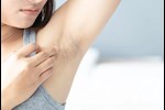 تبييض الأماكن الحساسة- هذا المنتج يعالج اسمرار الإبط والعانة