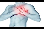 تليف الغشاء البلوري- طبيب يوضح كل ما تريد معرفته عنه