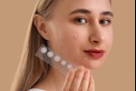 لصقات حب الشباب.. هل تسرع الشفاء لمسام الوجه؟ دراسة تجيب
