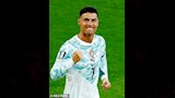 كيف غيرت عمليات التجميل نجوم كرة القدم العالميين؟ 4